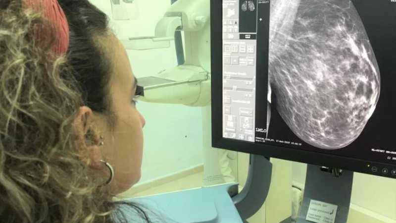 Hospital Parque inaugura su mamógrafo con mujeres de la AECC